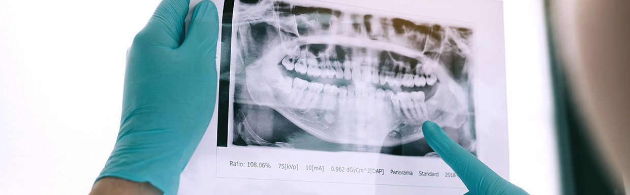 Radiographie dentaire : un outil essentiel pour la pratique dentaire moderne